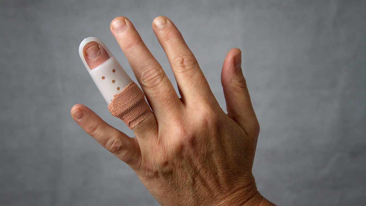 indemnizacion por perdida de un dedo en accidente laboral
